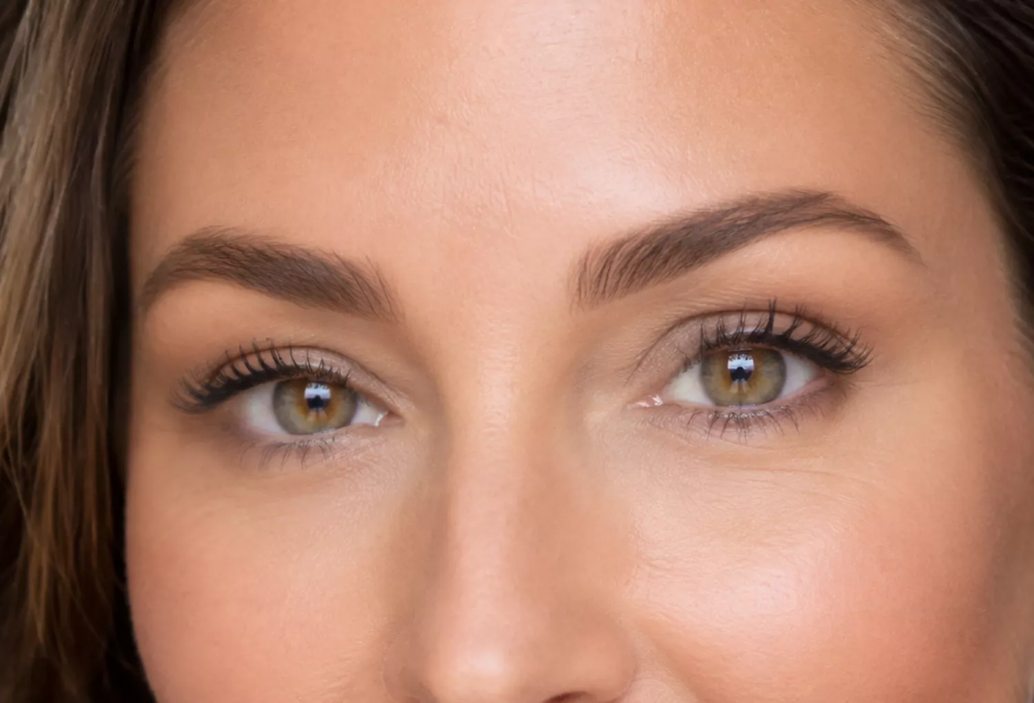 Brow Lift Brow Lift